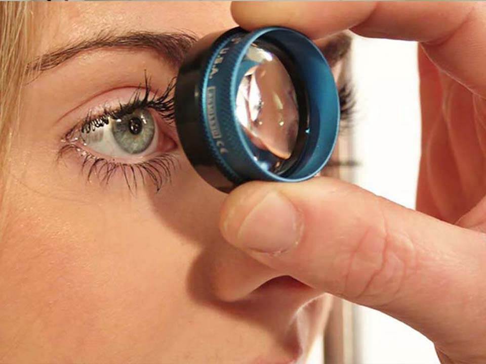 Gonioscopia exames hospital de olhos