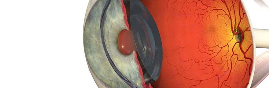 retinea e vitreo hospital de olhos de goiania2